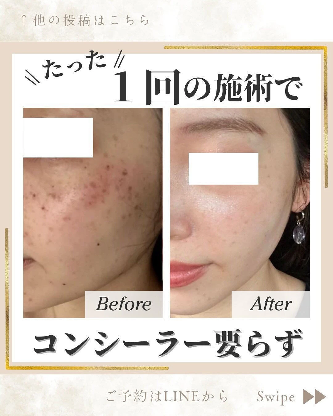 高知市にある | ブログ | 高知のエステならシミ・そばかす・肝斑専用