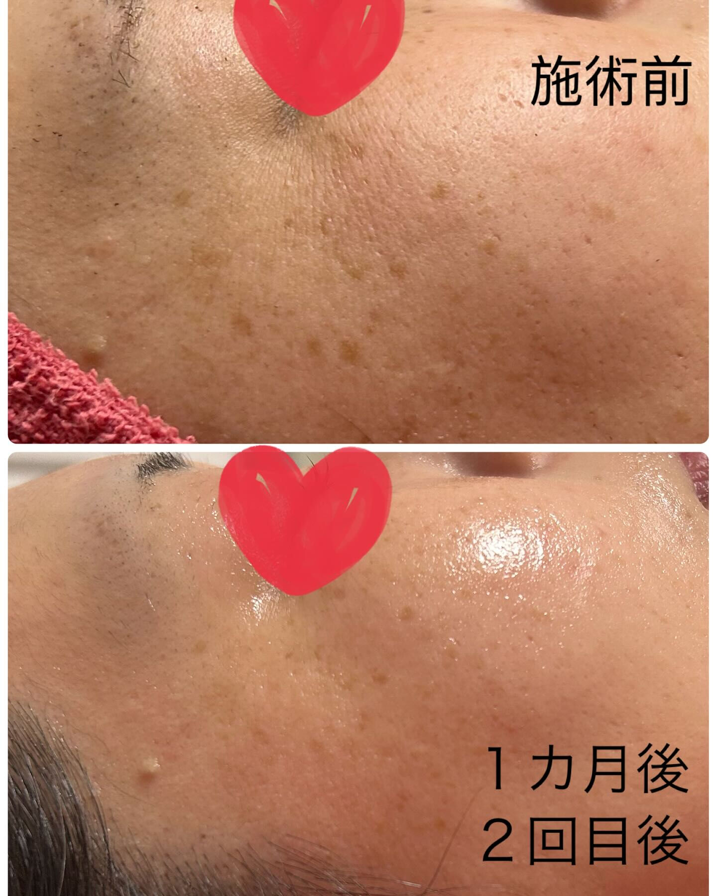 40代　女性「毎日見ていると変化に気づかなかったけど‼️月に