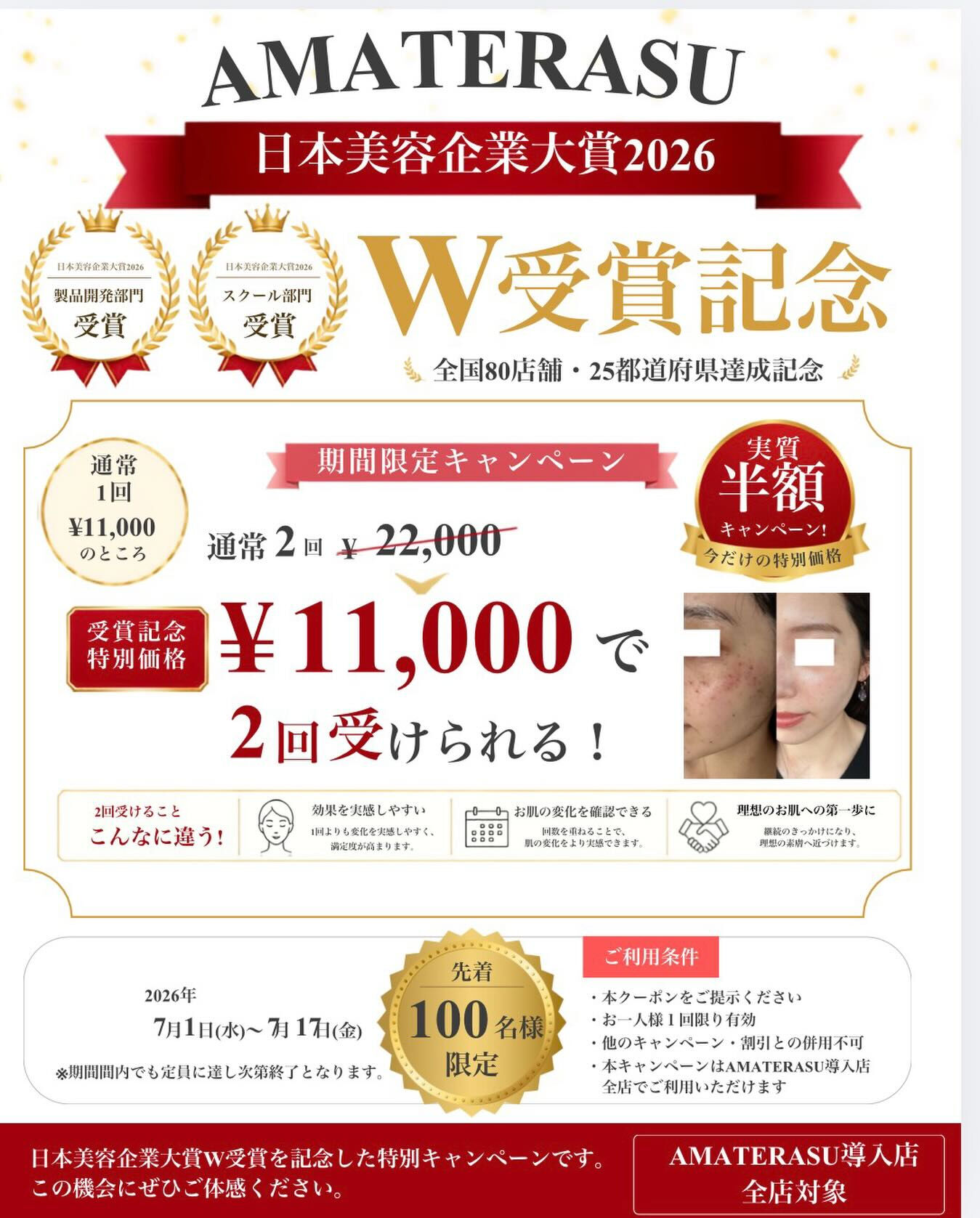 【今だけ実質5500円★】